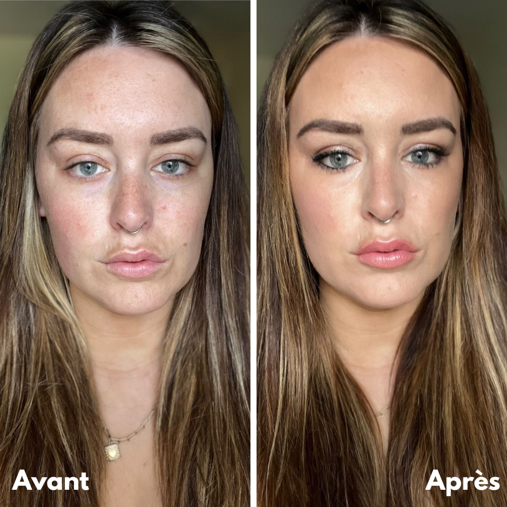 Luvaya™ - SkinFusion